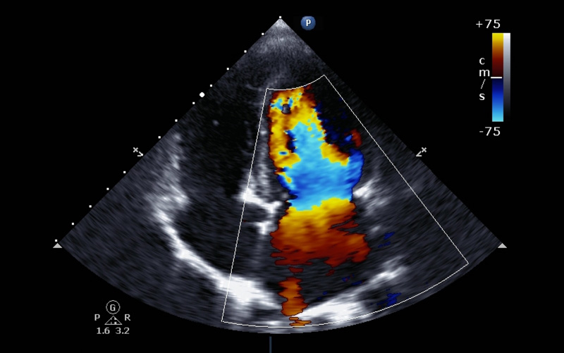 echocardiogram image