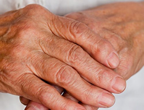 How Does Rheumatoid Arthritis Differ from Osteoarthritis?